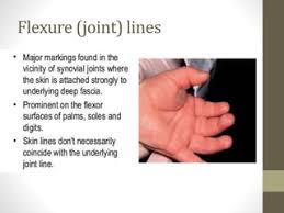 Cleavage Lines Vs Flexure Lines: What’S The Difference?